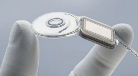 Image for Cochlear maintains profit growth and massive dividend payout ratio.