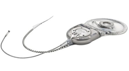 Image for Cochlear announces launch of new cochlear implant
