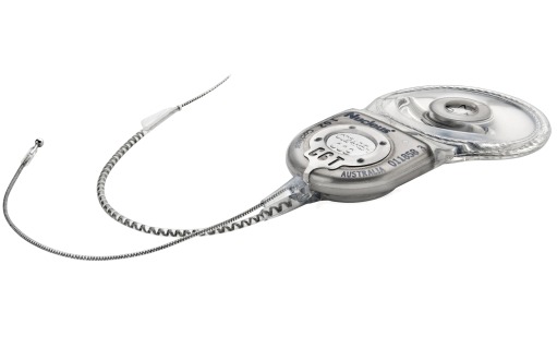 CochlearNucleus.Hybrid.Implant1.000