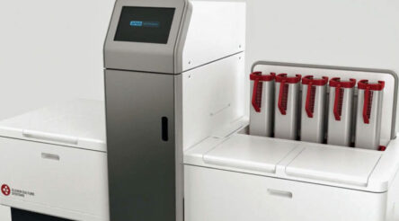 Image for LBT’s APAS AI machine achieves perfect result