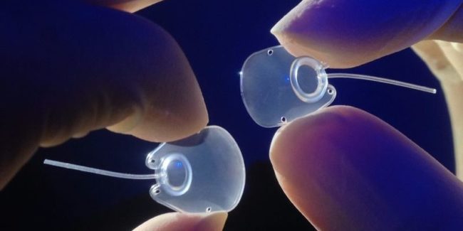 MOLTENO3 SL (on the left) and SS glaucoma implants