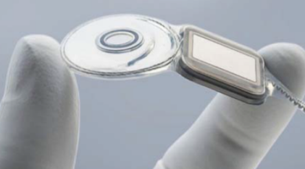 Image for Cochlear faces another patent battle
