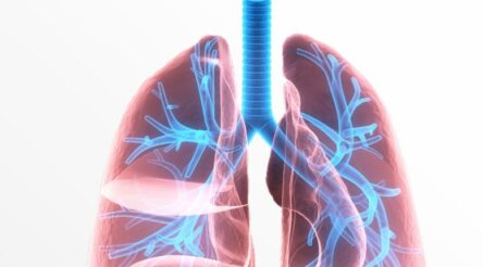 Image for Cyclopharm reports record sales, progress in the US