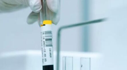 Image for BCAL Diagnostics opens for business in the US